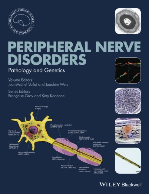 Joachim Weiss, Jean-Michel Vallat - Peripheral Nerve Disorders, E-bok