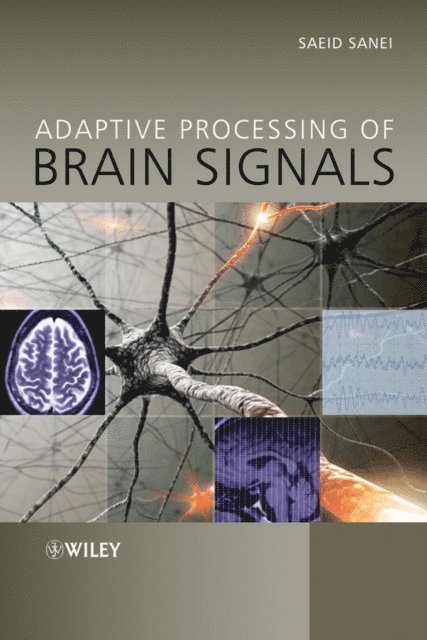 Saeid Sanei - Adaptive Processing of Brain Signals, E-bok
