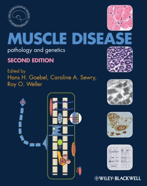 Roy O. Weller, Caroline A. Sewry, Hans H. Goebel - Muscle Disease, E-bok