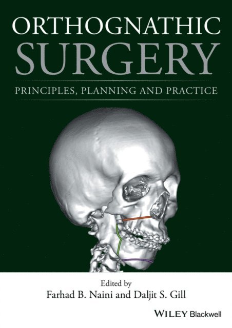 Daljit S. Gill, Farhad B. Naini - Orthognathic Surgery, E-bok