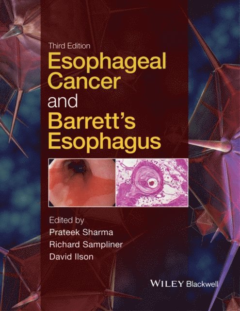 David Ilson, Richard Sampliner, Prateek Sharma - Esophageal Cancer and Barrett's Esophagus, E-bok