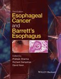 Esophageal Cancer and Barrett's Esophagus