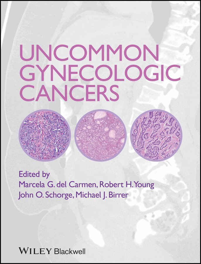 Marcela del Carmen, John O. Schorge, Robert H. Young - Uncommon Gynecologic Cancers. Tillgänglighet: Tillfälligt slut