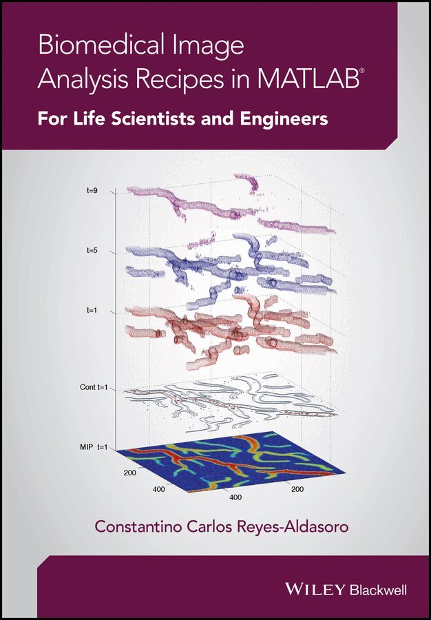 Constantino Carlos Reyes-Aldasoro - Biomedical Image Analysis Recipes in MATLAB® – For Life Scientists and Engineers. Tillgänglighet: Tillfälligt slut