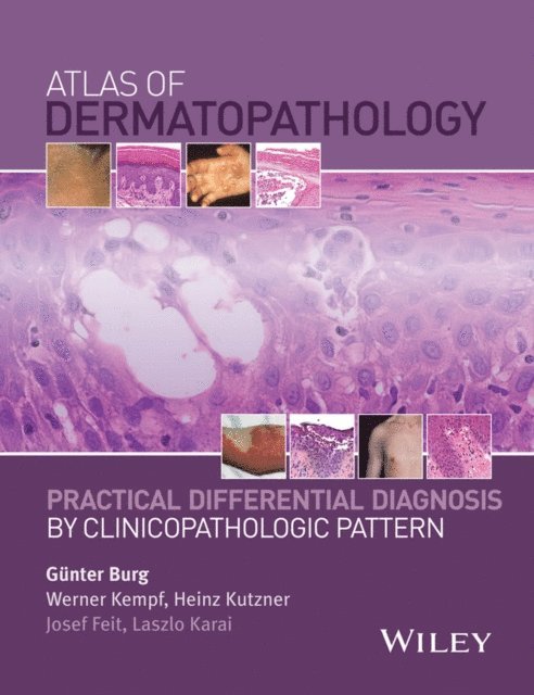 Laszlo Karai, Josef Feit, Heinz Kutzner, Werner Kempf, G nter Burg - Atlas of Dermatopathology, E-bok