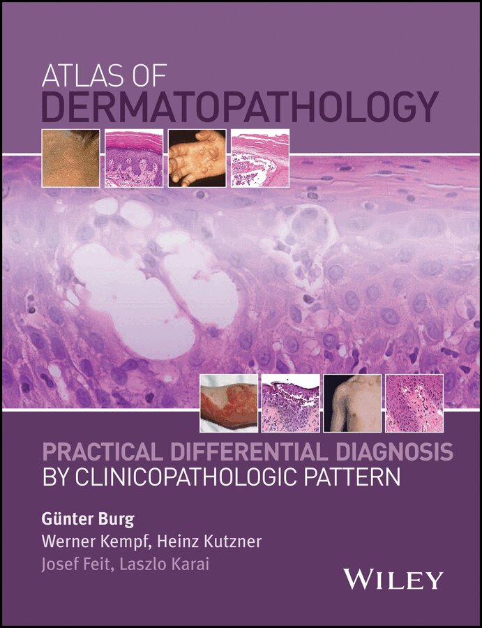 Günter Burg, Werner Kempf, Heinz Kutzner, Josef Feit, Laszlo Karai - Atlas of Dermatopathology – Practical Differential Diagnosis by Clinicopathologic Pattern. Tillgänglighet: Tillfälligt slut