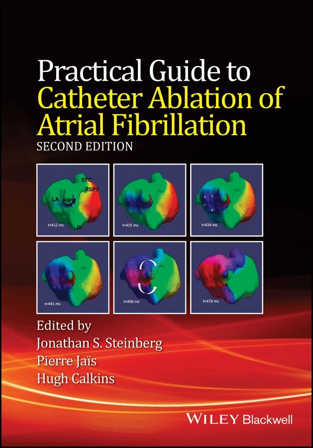 Jonathan S. Steinberg, Pierre Jais, Hugh Calkins - Practical Guide to Catheter Ablation of Atrial Fibrillation, 2e. Tillgänglighet: Tillfälligt slut