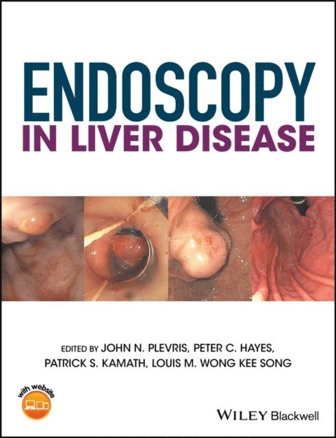 Louis-Michel Wong Kee Song, Patrick S. Kamath, Peter C. Hayes, John N. Plevris - Endoscopy in Liver Disease, E-bok