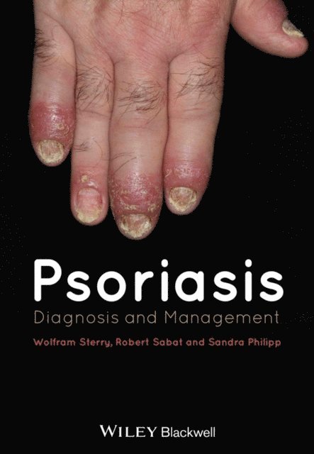 Sandra Philipp, Robert Sabat, Wolfram Sterry - Psoriasis, E-bok