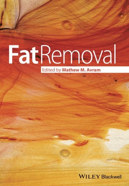 Mathew Avram - Fat Removal, E-bok
