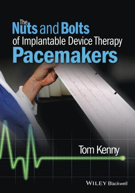 Tom Kenny - Nuts and Bolts of Implantable Device Therapy, E-bok