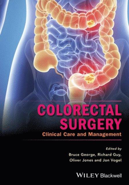 Jon Vogel, Oliver Jones, Richard Guy, Bruce George - Colorectal Surgery, E-bok
