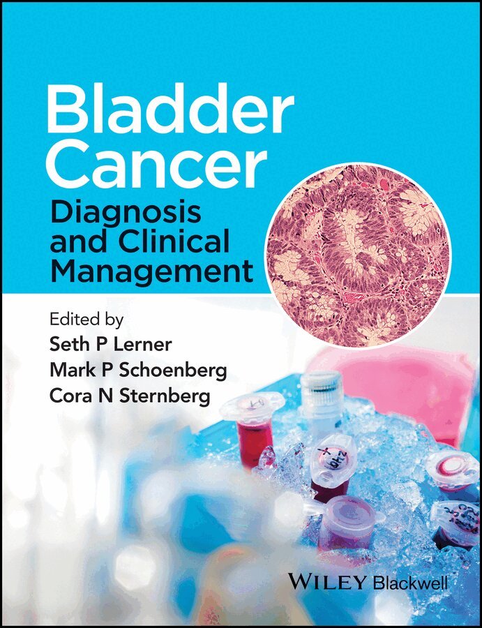 Seth P. Lerner, Mark P. Schoenberg, Cora N. Sternberg - Bladder Cancer – Diagnosis and Clinical Management. Tillgänglighet: Tillfälligt slut