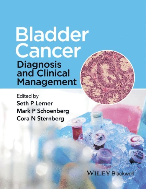 Cora N. Sternberg, Mark P. Schoenberg, Seth P. Lerner - Bladder Cancer, E-bok