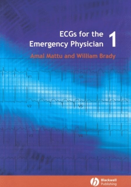 Amal Mattu, William J. Brady - ECGs for the Emergency Physician 1, E-bok
