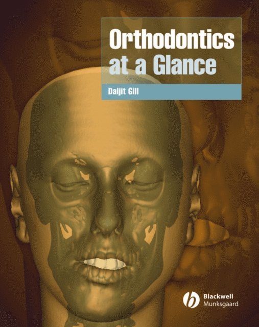 Daljit S. Gill - Orthodontics at a Glance, E-bok