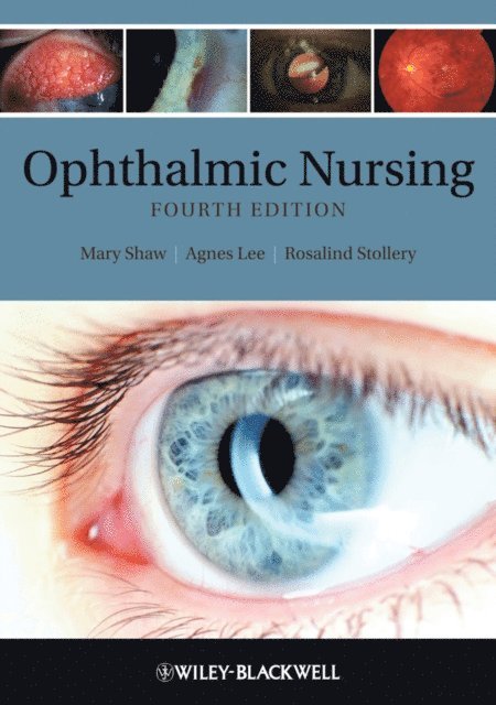 Rosalind Stollery, Agnes Lee, Mary E. Shaw - Ophthalmic Nursing, E-bok