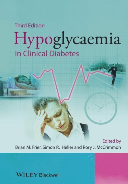 Rory McCrimmon, Simon Heller, Brian M. Frier - Hypoglycaemia in Clinical Diabetes, E-bok. Tillgänglighet: Lägg i varukorg