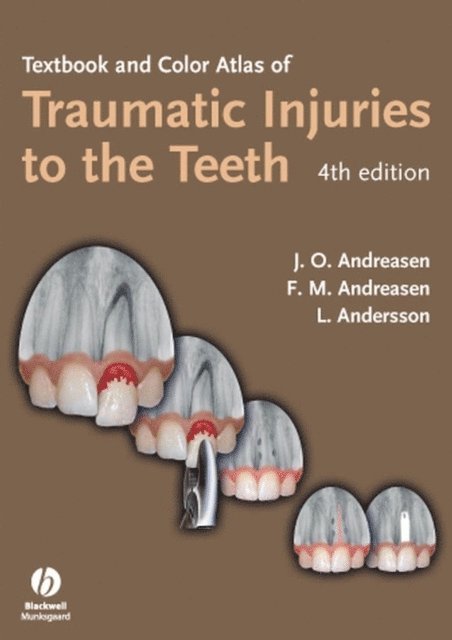 Lars Andersson, Frances M. Andreasen, Jens O. Andreasen - Textbook and Color Atlas of Traumatic Injuries to the Teeth, E-bok