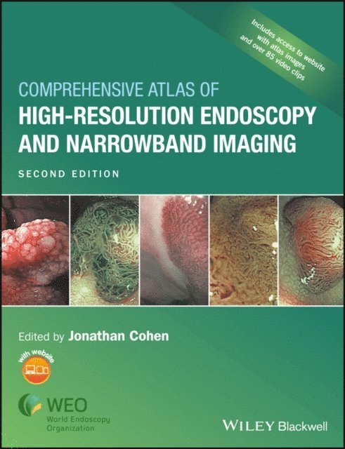 Jonathan Cohen - Comprehensive Atlas of High-Resolution Endoscopy and Narrowband Imaging, E-bok