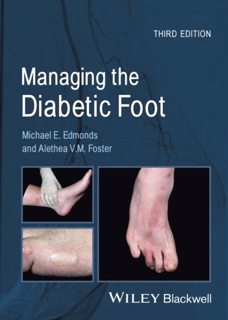 Alethea V. M. Foster, Michael E. Edmonds - Managing the Diabetic Foot, E-bok. Tillgänglighet: Lägg i varukorg