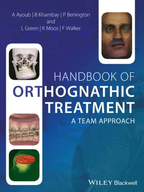 Fraser Walker, Khursheed Moos, Lyndia Green, Philip Benington, Balvinder Khambay, Ashraf Ayoub - Handbook of Orthognathic Treatment, E-bok. Tillgänglighet: Lägg i varukorg