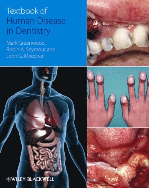 John Meechan, Robin Seymour, Mark Greenwood - Textbook of Human Disease in Dentistry, E-bok