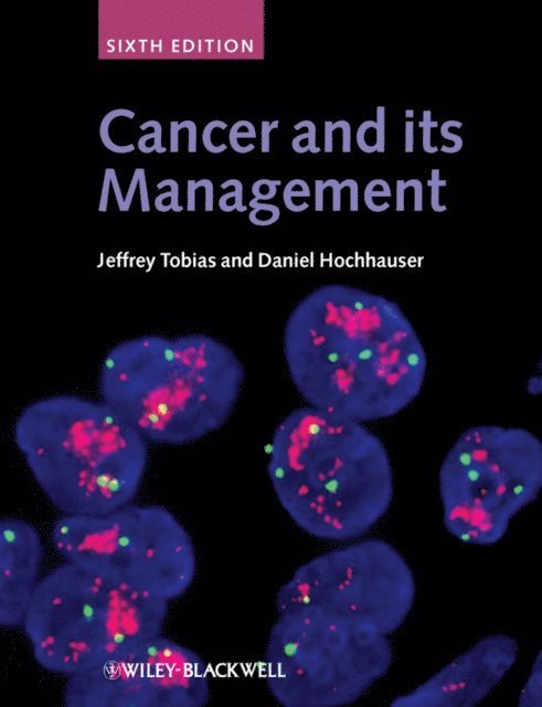 Daniel Hochhauser, Jeffrey S. Tobias - Cancer and its Management, E-bok