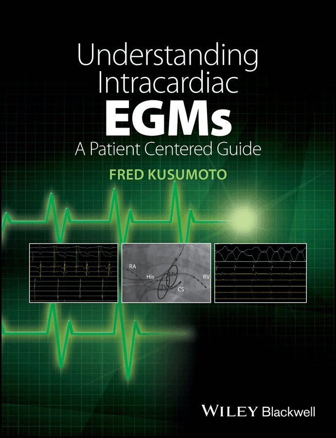 Fred M. Kusumoto - Understanding Intracardiac EGMs – A Patient Centered Guide. Tillgänglighet: Tillfälligt slut