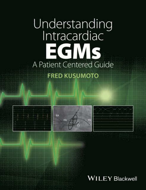 Fred M. Kusumoto - Understanding Intracardiac EGMs, E-bok. Tillgänglighet: Lägg i varukorg