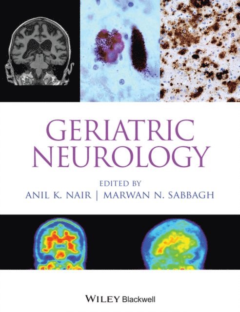 Marwan N. Sabbagh, Anil K. Nair - Geriatric Neurology, E-bok