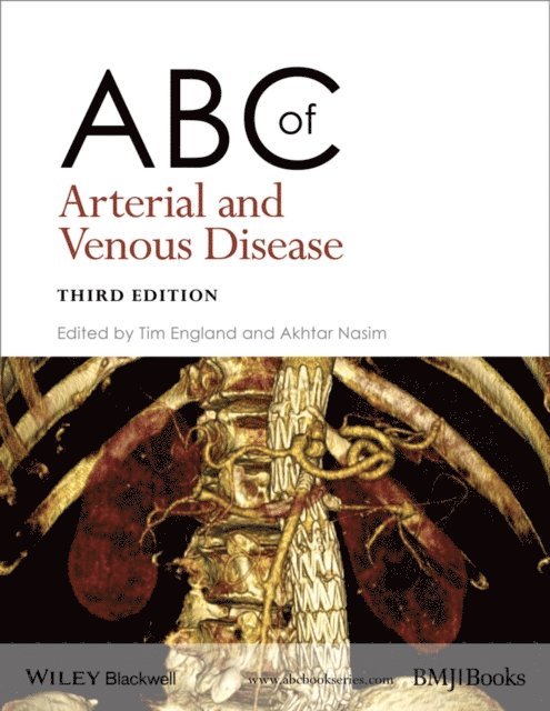 Akhtar Nasim, Tim England - ABC of Arterial and Venous Disease, E-bok