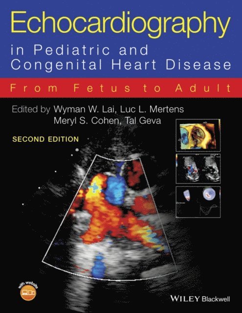 Tal Geva, Meryl S. Cohen, Luc L. Mertens, Wyman W. Lai - Echocardiography in Pediatric and Congenital Heart Disease, E-bok