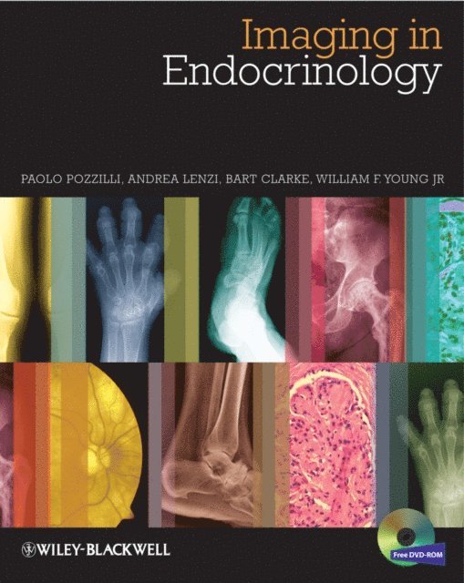 Jr. William F. Young, Bart L. Clarke, Andrea Lenzi, Paolo Pozzilli - Imaging in Endocrinology, E-bok