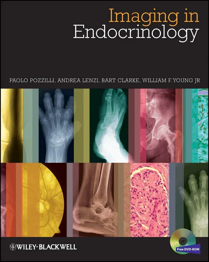 P Pozzilli - Imaging in Endocrinology. Tillgänglighet: Tillfälligt slut
