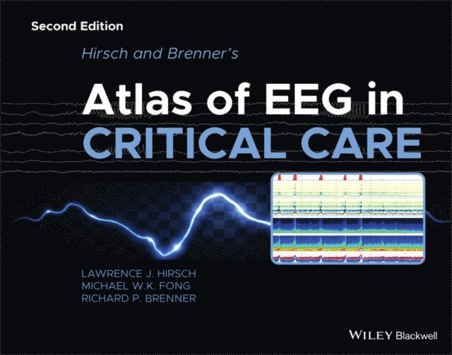 Richard P. Brenner, Michael W. K. Fong, Lawrence J. Hirsch - Hirsch and Brenner's Atlas of EEG in Critical Care, E-bok