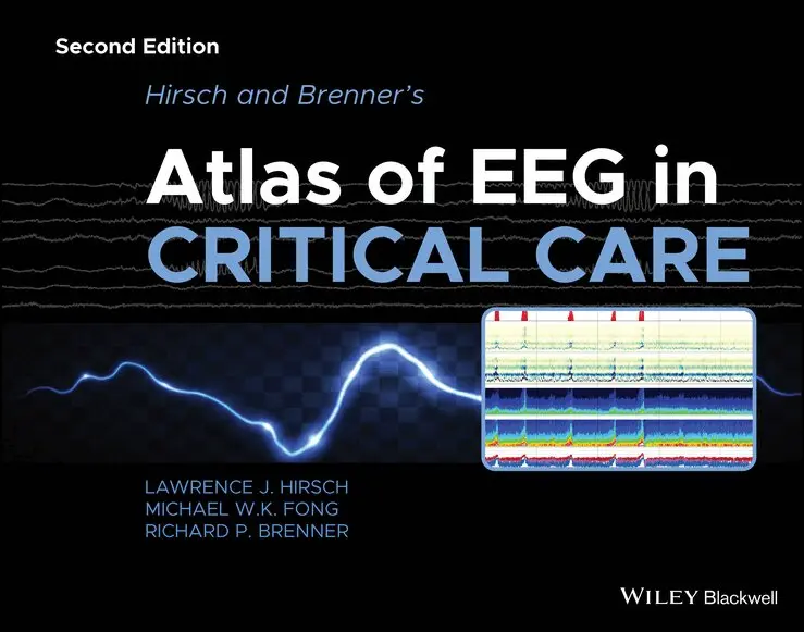 Lawrence J. Hirsch, Michael W. K. Fong, Richard P. Brenner - Hirsch and Brenner′s Atlas of EEG in Critical Care, 2nd Edition. Tillgänglighet: Tillfälligt slut
