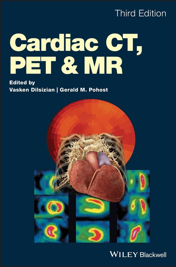 V Dilsizian - Cardiac CT, PET and MR. Tillgänglighet: Tillfälligt slut