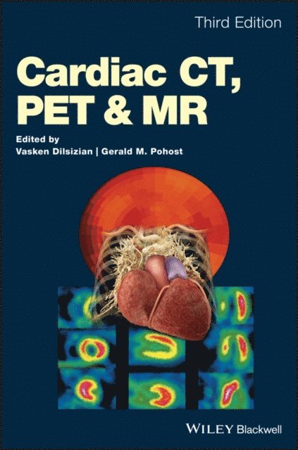 Gerald M. Pohost, Vasken Dilsizian - Cardiac CT, PET and MR, E-bok