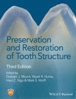 Graham J. Mount, Wyatt R. Hume, Hien C. Ngo, Mark S. Wolff - Preservation and Restoration of Tooth Structure, Inbunden