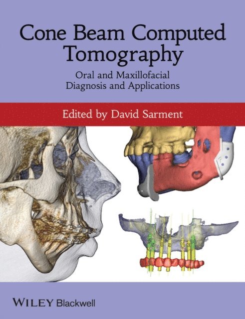 David Sarment - Cone Beam Computed Tomography, E-bok