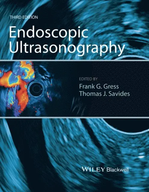 Thomas J. Savides, Frank G. Gress - Endoscopic Ultrasonography, E-bok. Tillgänglighet: Lägg i varukorg