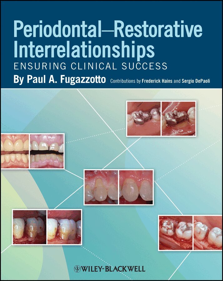 PA Fugazzotto - Periodontal Restorative Interrelationships. Tillgänglighet: Tillfälligt slut