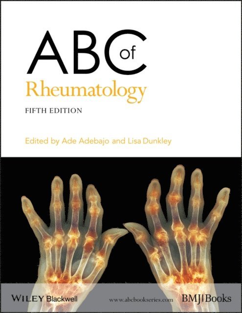 Lisa Dunkley, Ade Adebajo - ABC of Rheumatology, E-bok
