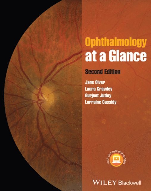 Laura Crawley, Gurjeet Jutley, Lorraine Cassidy, Jane Olver - Ophthalmology at a Glance, E-bok. Tillgänglighet: Lägg i varukorg