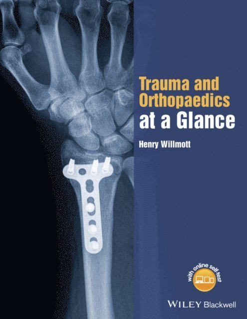 Henry Willmott - Trauma and Orthopaedics at a Glance, E-bok