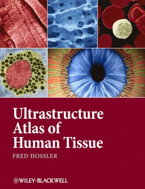 Fred Hossler - Ultrastructure Atlas of Human Tissues, E-bok