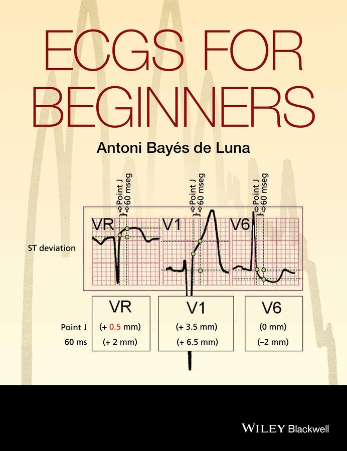 Antoni Bayés de Luna - ECGs for Beginners, E-bok