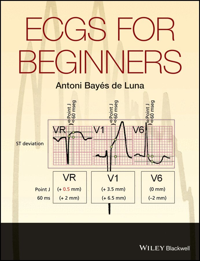 Antoni Bayés de Luna - ECGs for Beginners. Tillgänglighet: Tillfälligt slut