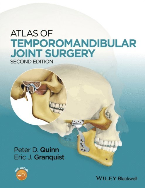 Eric J. Granquist, Peter D. Quinn - Atlas of Temporomandibular Joint Surgery, E-bok